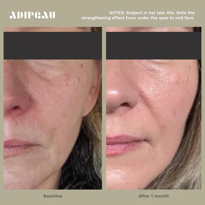 Adipeau Strength Gel