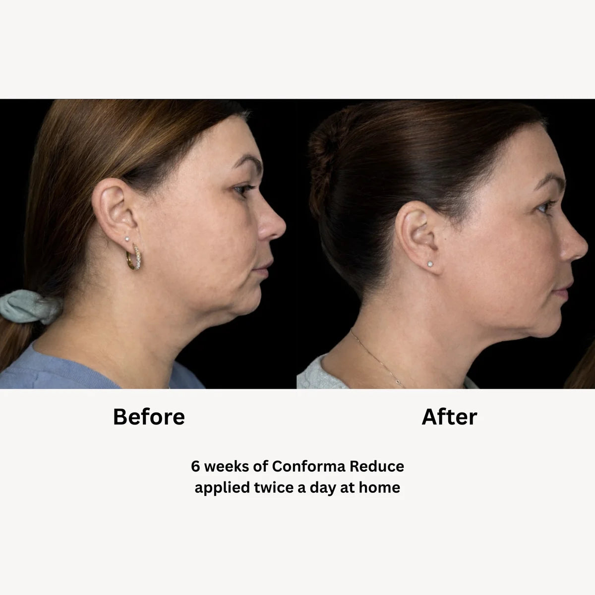 Conforma Reduce
